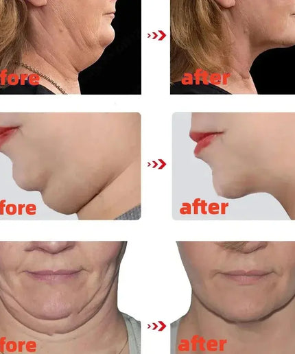 V Shape Slimming Cream Firming Face-lift Remove Masseter Muscle Double Chin Tighten Mandibular Fat Burning Cream Fade Neck Lines nkhluka
