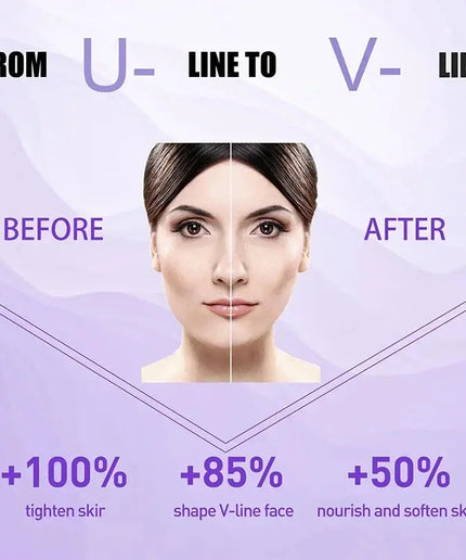 V Shape Slimming Cream Firming Face-lift Remove Masseter Muscle Double Chin Tighten Mandibular Fat Burning Cream Fade Neck Lines nkhluka